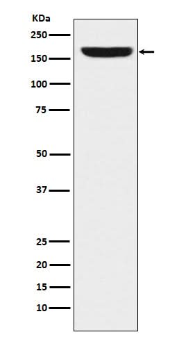 Anti-REST / NRSF Rabbit Monoclonal Antibody Boster Bio
