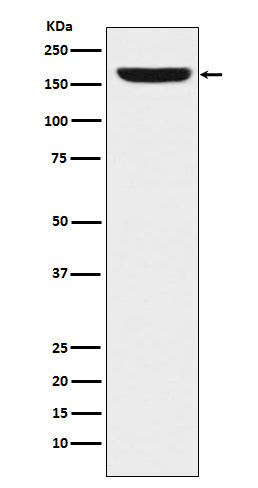 Anti-REST / NRSF Rabbit Monoclonal Antibody Boster Bio
