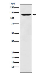 Anti-PCB Rabbit Monoclonal Antibody Boster Bio