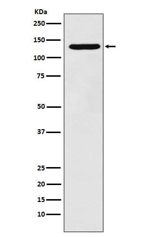 Anti-PCB Rabbit Monoclonal Antibody Boster Bio