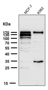 Anti-ATAD2 Rabbit Monoclonal Antibody Boster Bio
