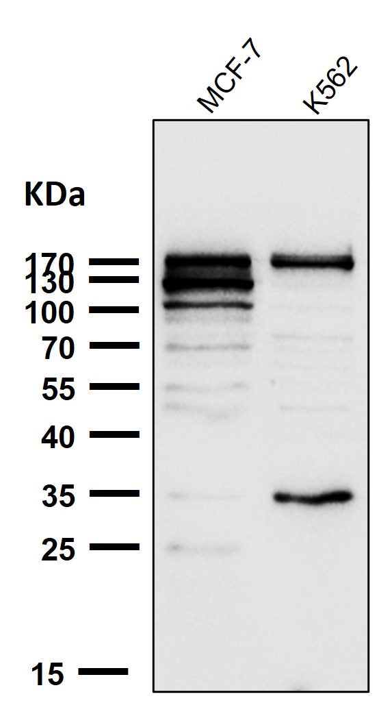 Anti-ATAD2 Rabbit Monoclonal Antibody Boster Bio