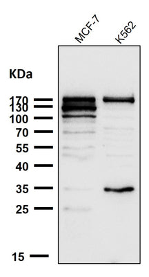 Anti-ATAD2 Rabbit Monoclonal Antibody Boster Bio