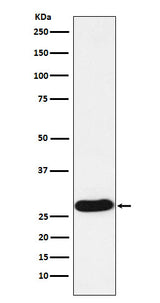 Anti-PR3 Rabbit Monoclonal Antibody Boster Bio