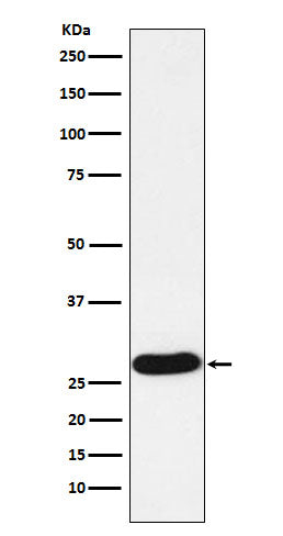 Anti-PR3 Rabbit Monoclonal Antibody Boster Bio