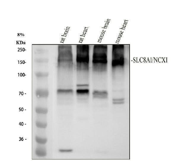 Anti-NCX1 Rabbit Monoclonal Antibody Boster Bio