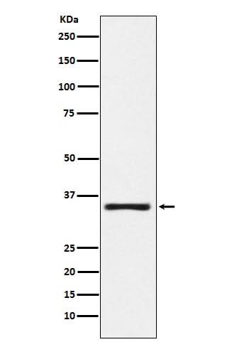 Anti-KLK2 Rabbit Monoclonal Antibody Boster Bio