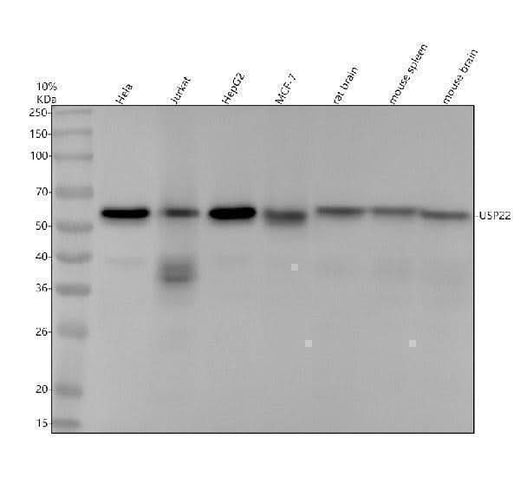Anti-USP22 Rabbit Monoclonal Antibody Boster Bio