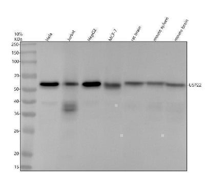 Anti-USP22 Rabbit Monoclonal Antibody Boster Bio
