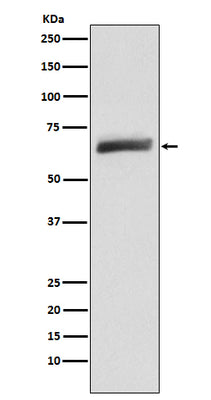 Anti-USP22 Monoclonal Antibody Boster Bio