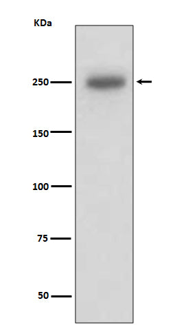 Anti-Laminin beta 1 LAMB1 Rabbit Monoclonal Antibody Boster Bio