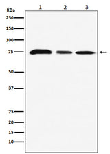 Anti-KAT7 / HBO1 / MYST2 Monoclonal Antibody Boster Bio