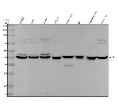 Anti-Arp2 Rabbit Monoclonal Antibody Boster Bio