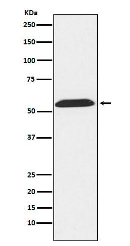 Anti-TXNRD2 Rabbit Monoclonal Antibody Boster Bio