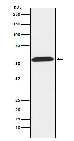 Anti-TXNRD2 Rabbit Monoclonal Antibody Boster Bio