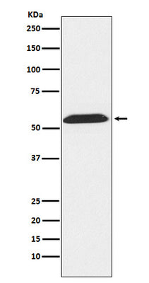 Anti-TXNRD2 Rabbit Monoclonal Antibody Boster Bio