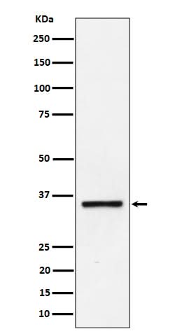 Anti-Kallikrein 8 Rabbit Monoclonal Antibody Boster Bio