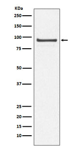 Anti-Cdc27/APC3 Rabbit Monoclonal Antibody Boster Bio