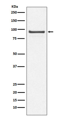 Anti-Cdc27/APC3 Rabbit Monoclonal Antibody Boster Bio