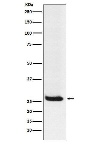 Anti-Hippocalcin Rabbit Monoclonal Antibody Boster Bio
