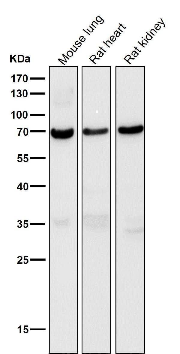 Anti-Perilipin A PLIN1 Rabbit Monoclonal Antibody Boster Bio