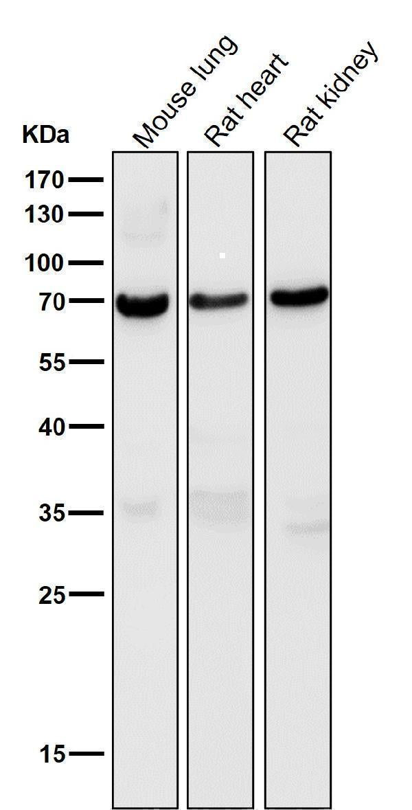Anti-Perilipin A PLIN1 Rabbit Monoclonal Antibody Boster Bio