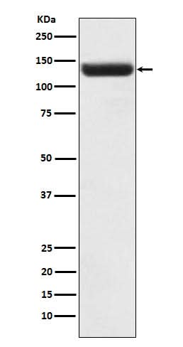Anti-ZNF217 Rabbit Monoclonal Antibody Boster Bio