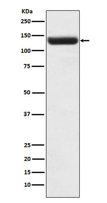 Anti-ZNF217 Rabbit Monoclonal Antibody Boster Bio