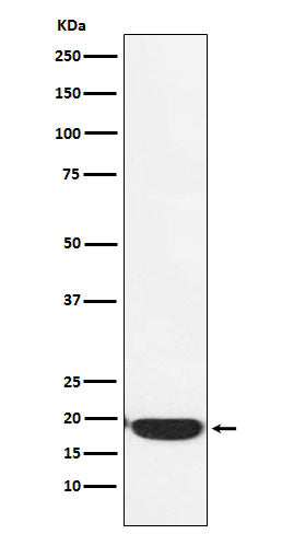 Anti-PERP Monoclonal Antibody Boster Bio