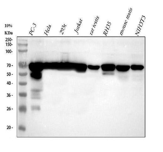 Anti-NUP62 Rabbit Monoclonal Antibody Boster Bio