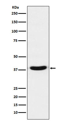 Anti-VPS26 VPS26A Monoclonal Antibody Boster Bio