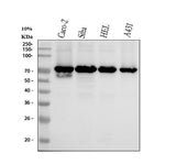 Anti-p60 CAF1 Rabbit Monoclonal Antibody Boster Bio