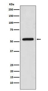 Anti-CaMKII Monoclonal Antibody Boster Bio