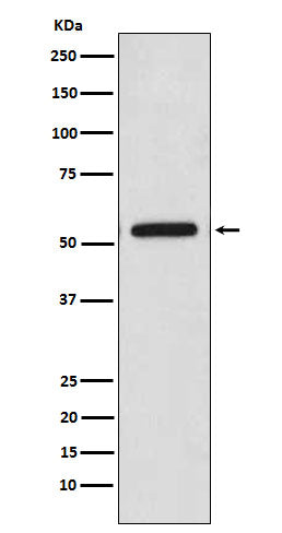 Anti-CaMKII Monoclonal Antibody Boster Bio