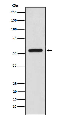 Anti-CaMKII Monoclonal Antibody Boster Bio