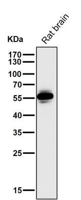 Anti-CaMKII CAMK2B Rabbit Monoclonal Antibody Boster Bio