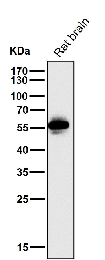 Anti-CaMKII CAMK2B Rabbit Monoclonal Antibody Boster Bio