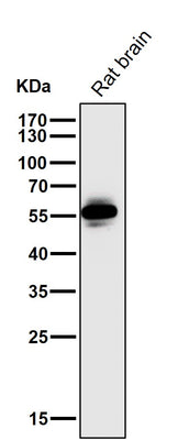 Anti-CaMKII CAMK2B Rabbit Monoclonal Antibody Boster Bio