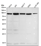 Anti-WASF2 Rabbit Monoclonal Antibody Boster Bio