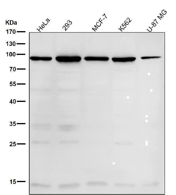 Anti-WASF2 Rabbit Monoclonal Antibody Boster Bio