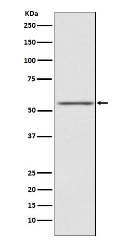 Anti-AMHR2 Rabbit Monoclonal Antibody Boster Bio