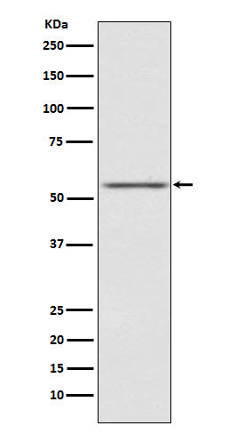 Anti-AMHR2 Rabbit Monoclonal Antibody Boster Bio
