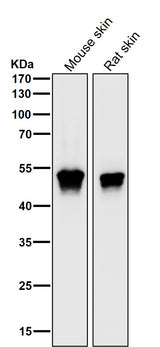 Anti-MEK5 Rabbit Monoclonal Antibody Boster Bio