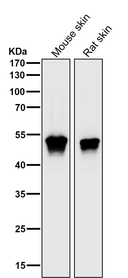 Anti-MEK5 Rabbit Monoclonal Antibody Boster Bio