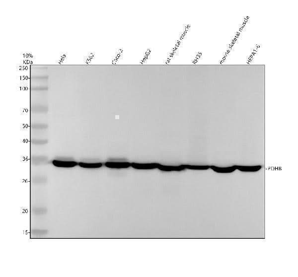 Anti-Pyruvate Dehydrogenase E1 beta subunit PDHB Monoclonal Antibody Boster Bio
