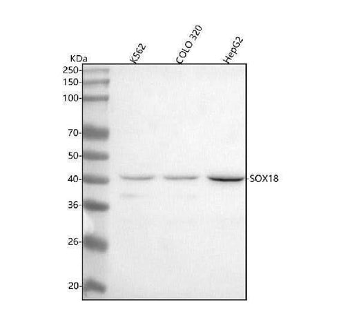 Anti-SOX18 Rabbit Monoclonal Antibody Boster Bio