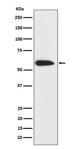 Anti-Cytokeratin 6 Rabbit Monoclonal Antibody Boster Bio