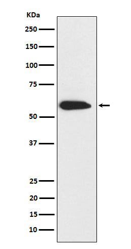 Anti-Cytokeratin 6 Rabbit Monoclonal Antibody Boster Bio