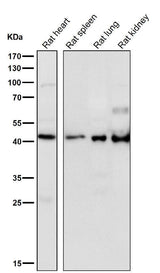 Anti-HOXA5 Rabbit Monoclonal Antibody Boster Bio