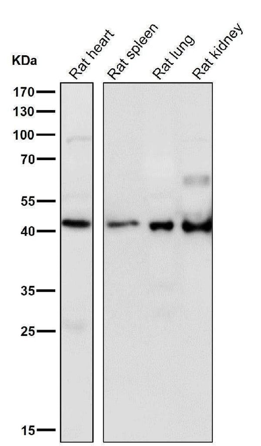 Anti-HOXA5 Rabbit Monoclonal Antibody Boster Bio